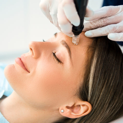 Micro-needling